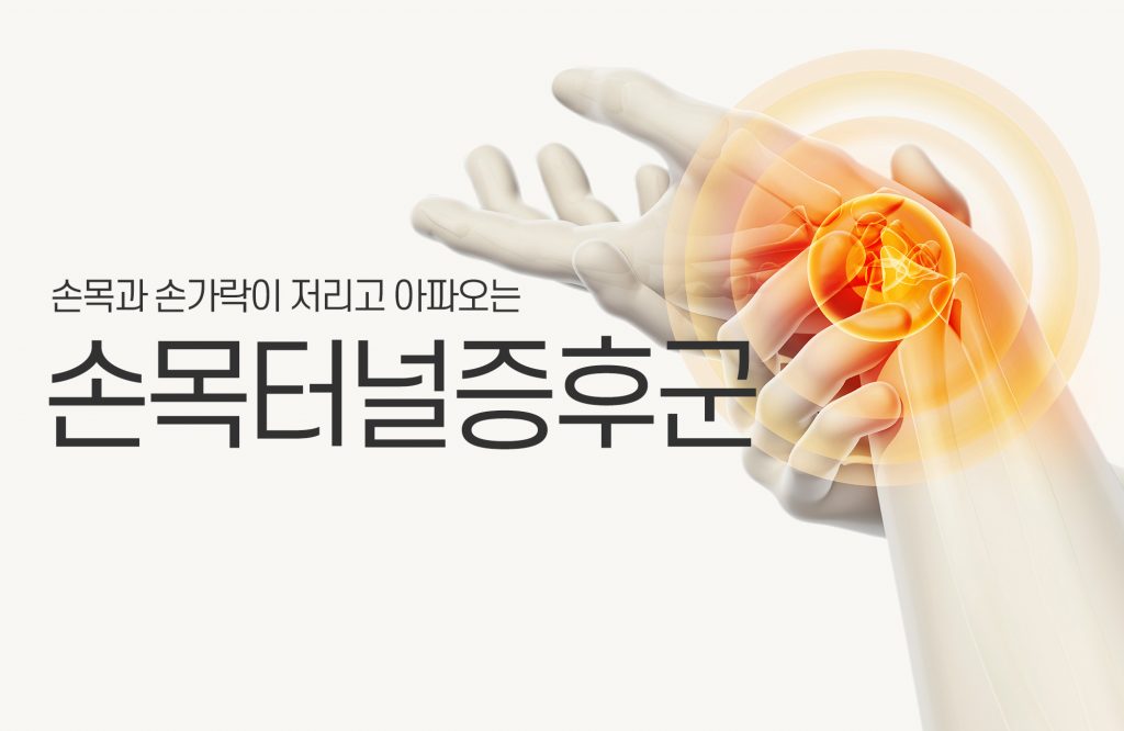 당진 신경외과] 손목터널증후군 : 원인과 효과적인 관리법