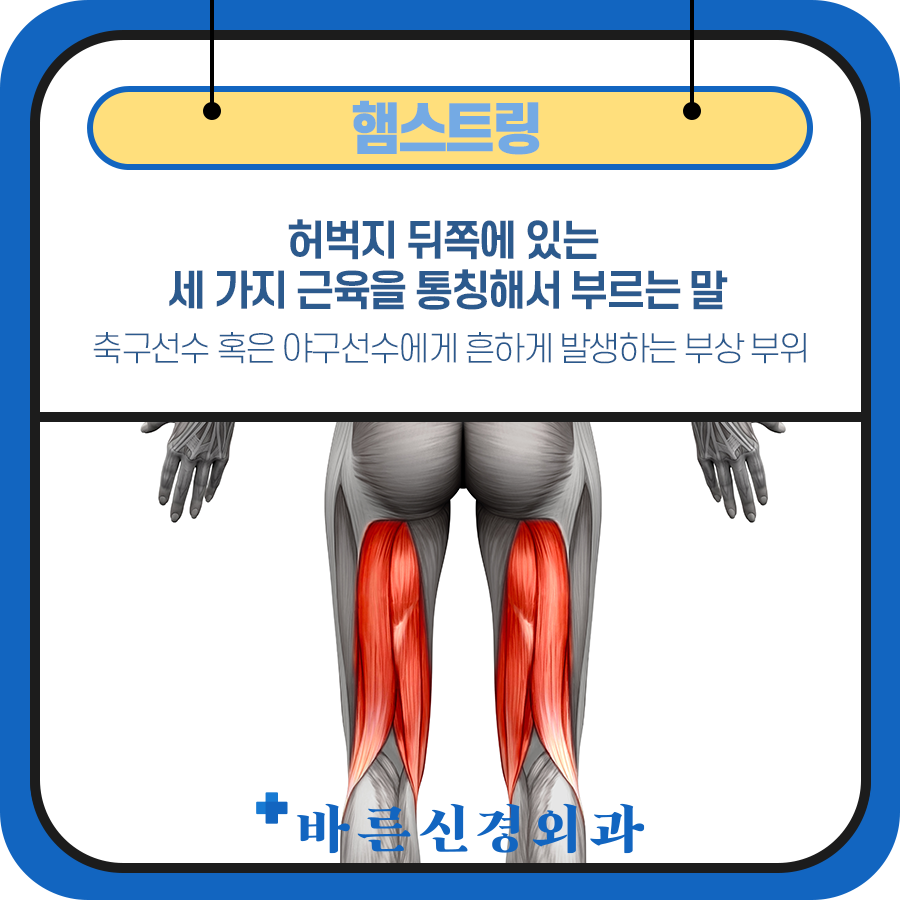 허벅지 뒤쪽 햄스트링의 고통스러운 파열에 주의 4